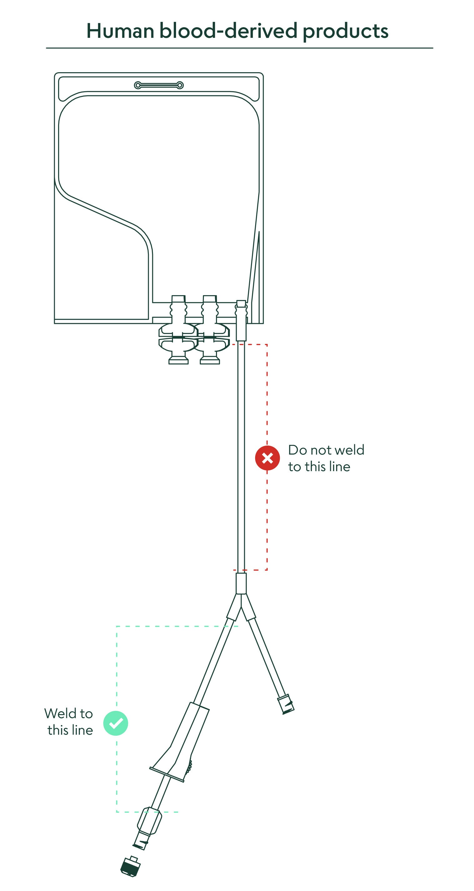 AB Serum CSS Bag Diagram